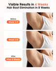 IPL Devices Hair Removal Laser