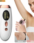 HOMEFISH Laser Epilator IPL Hair Removal
